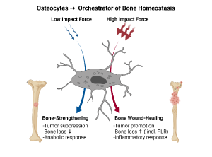Breast Cancer Bone Metastasis