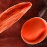 Sickle cell